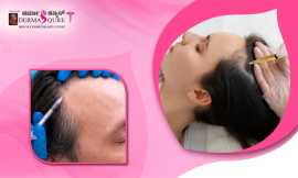 Advanced GFC Treatment in Bangalore by Dermaqure, Bengaluru