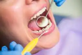  Affordable Teeth Gap Filling Cost: Options , Delhi