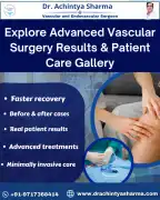 Explore Advanced Vascular Surgery Results & Patien, Noida