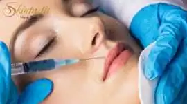 Best Lip Fillers Riverside for Plump Lips, Riverside