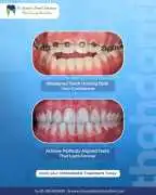 Best Dentist in Noida for Painless Root Canal , Noida