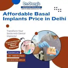 Affordable Basal Implants Price: DentalClinicDelhi, Delhi