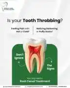 Painless Root Canal Treatment in Noida , Noida