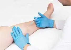 Expert Advice From Vein Treatment Doctors, San Diego