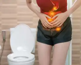 fistula treatment in noida, Noida