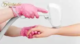 Flawless Skin with Laser Hair Removal in Riverside, Riverside