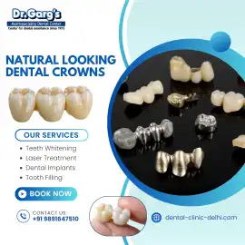 Natural Looking Dental Crowns:Dental Clinic Delhi, Delhi