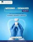 Expert Dental Crowns ,Bridges in Noida ,Book Today, Noida