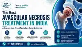 Best Avascular Necrosis Treatment in India, Indore