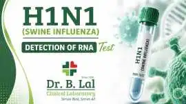 H1N1 Swine Flu RNA Detection | Accurate Results, Jaipur