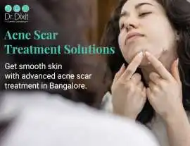 Acne Scar Treatment In Bangalore, Bengaluru