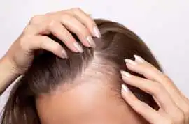 Discover Expert Hair Loss Solutions at Zoya Salon, Carrollton