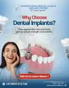 Affordable Dental Implant Cost in Delhi – Enquire , New Delhi
