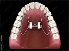 Are there any orthodontists offering braces near m, North Miami Beach