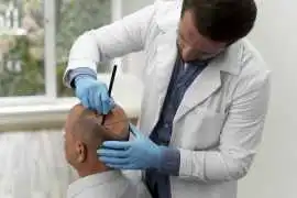 Hair Loss Treatment Lucknow | Advanced Care, Lucknow