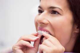 Get the Best Custom Dentures Online in California, Ventura
