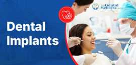 Restore Your Smile with Affordable Dental Implants, Ahmedabad