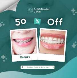 Teeth Clip Treatment in Coimbatore, Coimbatore