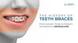 Expert Dental Braces Treatment in Ahmedabad | Top , Ahmedabad