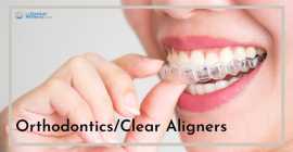 Achieve a Perfect Smile with Clear Aligners , Ahmedabad