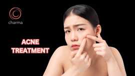 Acne treatment in Bangalore, Bengaluru