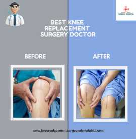 Best Knee replacement surgery doctor, Ahmedabad