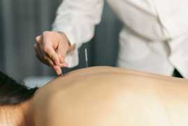 Achieve Wellbeing with Acupuncture Centre London, London