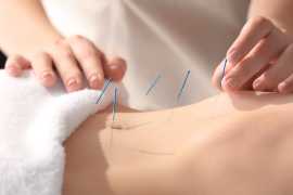 Achieve Optimal Health with Acupuncture in Central, London