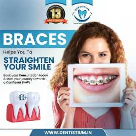Transform Your Smile with Braces at Dentistium!, Ahmedabad