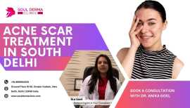 Acne Scar Treatment in South Delhi, Delhi