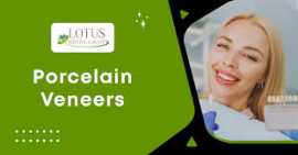 Porcelain Veneers in Campbell Transform Your Smile, Campbell
