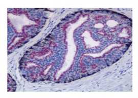 Buy Dako Antibodies  at DSS Imagetech, $ 0
