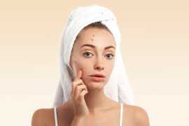 Mumbai’s Best Skin Specialists at MS Medical Care, Mumbai
