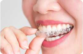 Affordable Braces at The Smile Spa, Mumbai