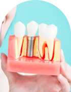 Dental Implant Treatment in Noida, Noida