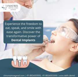 Full Mouth Dental Implant Cost in South Delhi, Delhi
