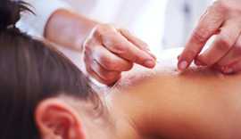 Acupuncture for IVF Support, New York