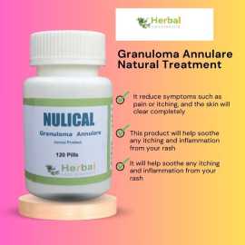 Herbal Supplement for Granuloma Annulare, Amado