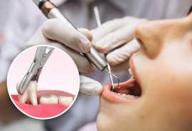 Pleasant Dental’s Expert Wisdom Tooth Extraction , Euless