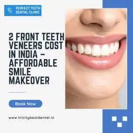2 Front Teeth Veneers Cost in India, Chandigarh