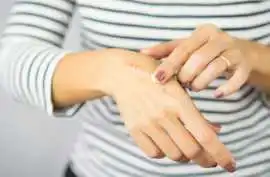 Advanced Burn Scar Cosmetic Surgery in Delhi, Noida