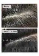Real Care with Natural Scalp Treatment That Suppor, Melbourne
