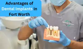 Teeth whitening Fort Worth, Fort Worth
