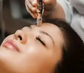Microneedling Facial Experts in Islington London, London