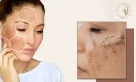 Aafiyat Advanced Aesthetic's Treatments for Bright, Mississauga