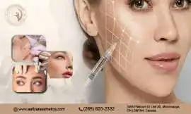 Non-Surgical Botox Treatments in Mississauga–Aafiy, Mississauga