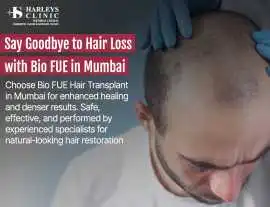 Trusted Clinic for FUE Hair Transplant in Mumbai, Mumbai