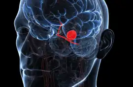 Precision Brain Coiling That Saves Lives, Chandigarh