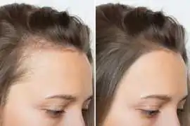 Nano Brows Near Vancouver WA | Natural Eyebrow, Vancouver