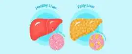 Support Healthy Liver Function Naturally, Nashik
